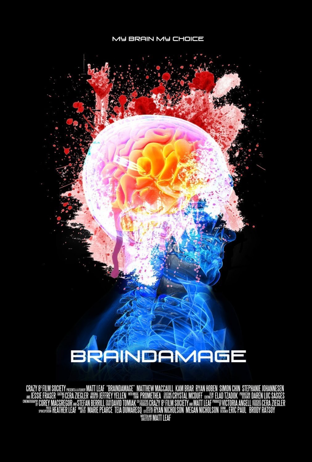 Extra Large Movie Poster Image for Braindamage
